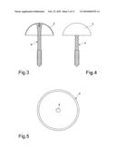 Coxo-femoral surface prosthesis for veterinary use diagram and image