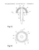 Coxo-femoral surface prosthesis for veterinary use diagram and image