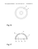 Coxo-femoral surface prosthesis for veterinary use diagram and image