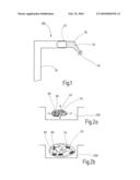 THREE-DIMENSIONAL ARTIFICIAL CALLUS DISTRACTION diagram and image