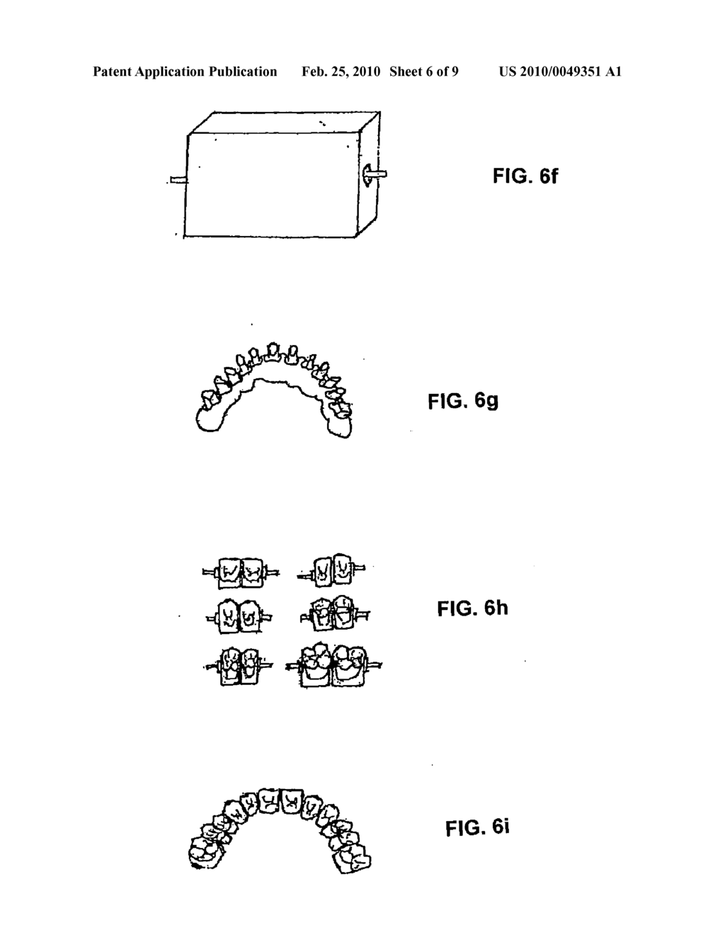 METHOD AND SYSTEM FOR PRODUCING A DENTAL PROTHESIS - diagram, schematic, and image 07