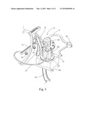 FUEL VAPORIZER FOR FUEL INJECTED ENGINES diagram and image