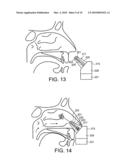 DELIVERY DEVICE AND METHOD diagram and image