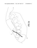 Dental floss Combined with Powders diagram and image