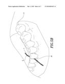 Dental floss Combined with Powders diagram and image