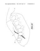 Dental floss Combined with Powders diagram and image