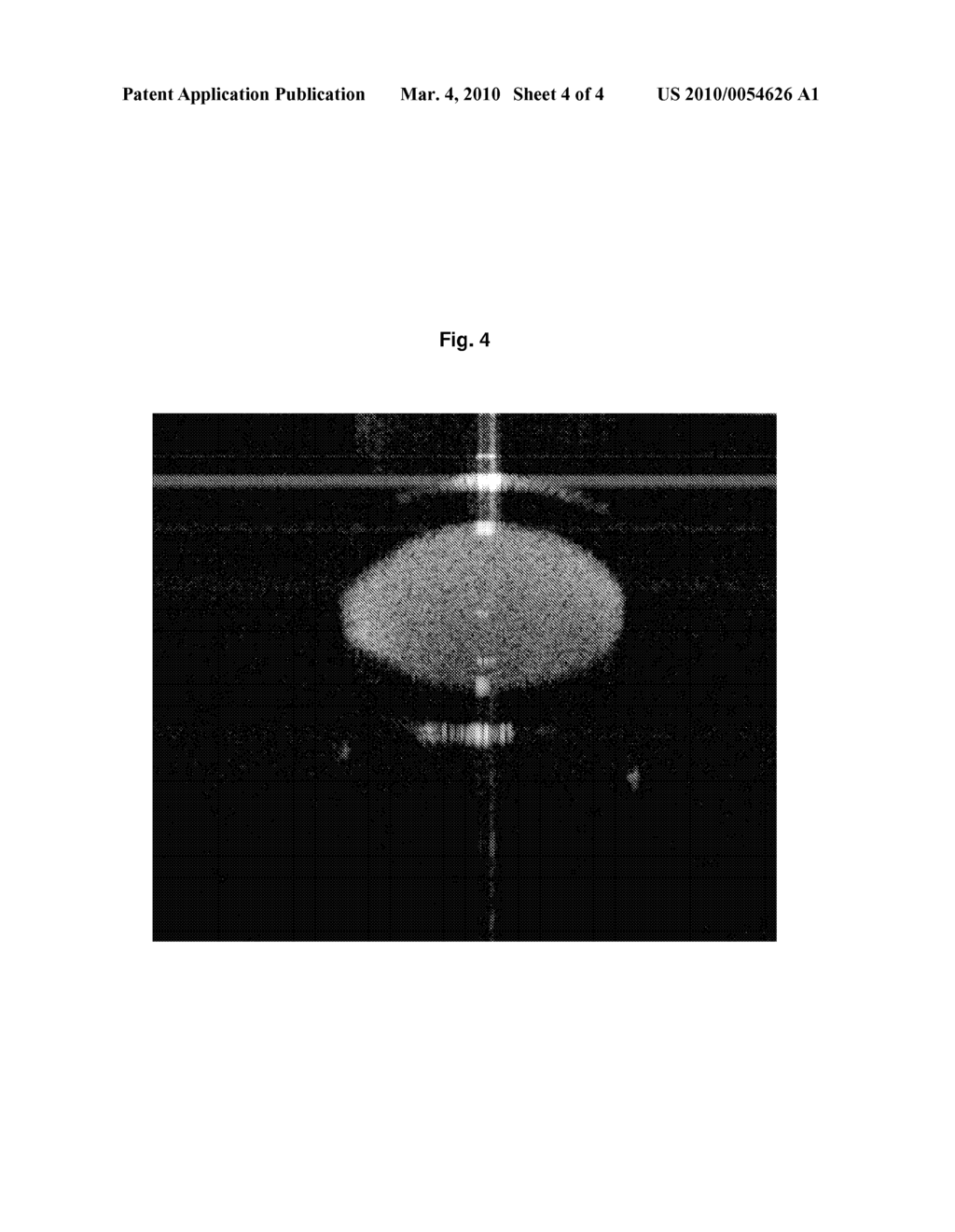 METHOD OF FAST IMAGE RECONSTRUCTION - diagram, schematic, and image 05