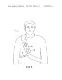 CAMERA CARRYING DEVICE WITH LOCKING MECHANISM diagram and image