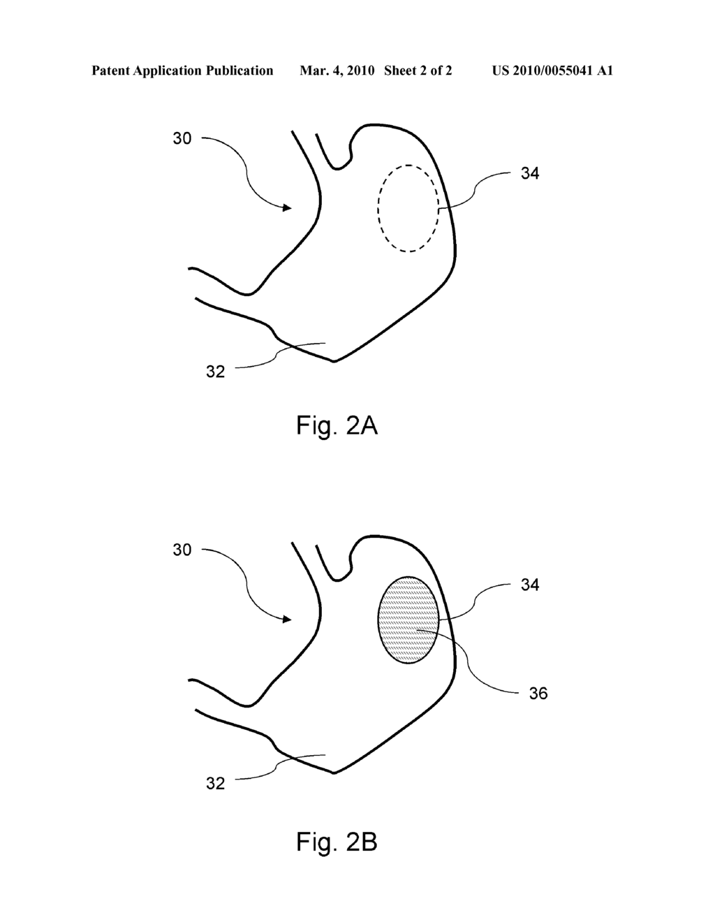 NANOTRACER FOR IN-SITU GASTRIC CANCER DETECTION - diagram, schematic, and image 03