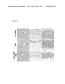 METHODS FOR PREVENTING HEMATOLOGICAL MALIGNANCIES AND GRAFT VERSUS HOST DISEASE BY ANTI-CD3 PRECONDITIONING diagram and image