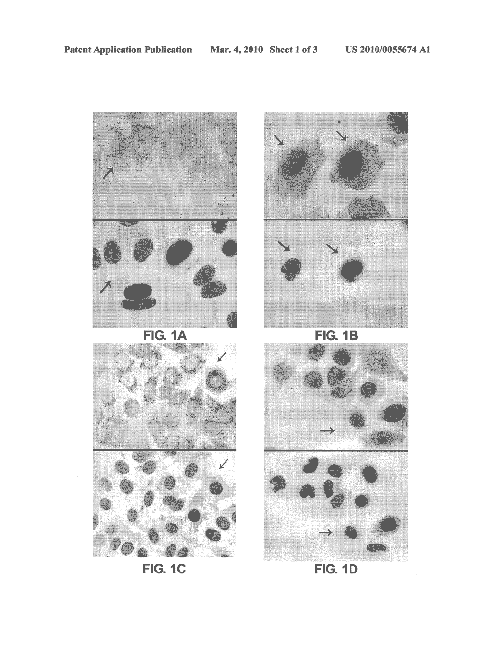 UTILIZING LIVER CELL LINE QSG-7701 TO BE INFECTED WITH HEPATITIS B VIRUS - diagram, schematic, and image 02