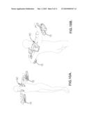 Abdominal Exercise Apparatus diagram and image
