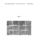 Method for Inhibiting Angiogenesis diagram and image