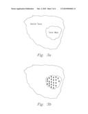 BRACHYTHERAPY SEED WITH FAST DISSOLVING MATRIX FOR OPTIMAL DELIVERY OF RADIONUCLIDES TO CANCER TISSUE diagram and image