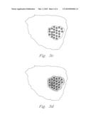 BRACHYTHERAPY SEED WITH FAST DISSOLVING MATRIX FOR OPTIMAL DELIVERY OF RADIONUCLIDES TO CANCER TISSUE diagram and image