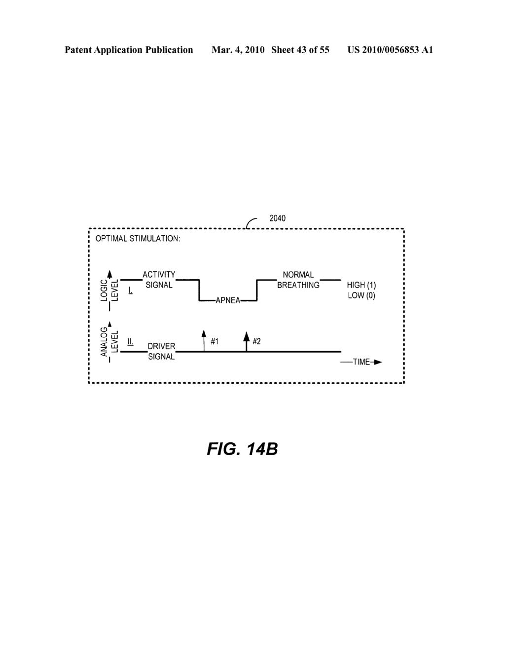 Stimulus generator for a closed loop neuromodulator - diagram, schematic, and image 44