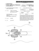 ACTUATOR FOR INTRADUCTAL MOVING BODY AND ENDOSCOPE diagram and image