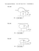 ACTUATOR FOR INTRADUCTAL MOVING BODY AND ENDOSCOPE diagram and image