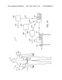 Method and Apparatus For Acute Cardiac Monitoring diagram and image