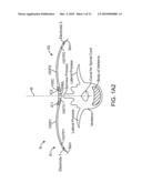 Method and Apparatus For Acute Cardiac Monitoring diagram and image