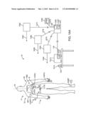 Method and Apparatus For Acute Cardiac Monitoring diagram and image