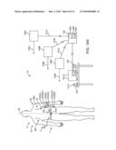 Method and Apparatus For Acute Cardiac Monitoring diagram and image