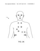 Method and Apparatus For Acute Cardiac Monitoring diagram and image