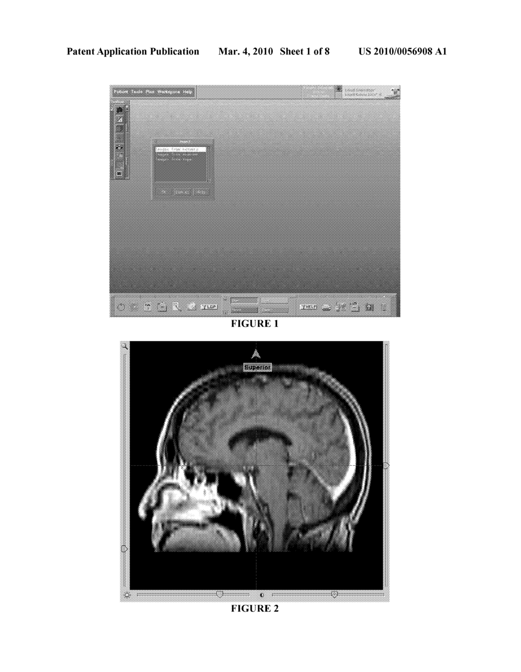 SYSTEM AND METHOD FOR PRE-PLANNING A RADIATION TREATMENT - diagram, schematic, and image 02