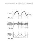 RAPID NON-INVASIVE BLOOD PRESSURE MEASURING DEVICE diagram and image