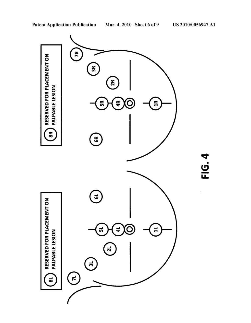 Placeholder for collecting and analyzing thermal data based on breast surface temperature to determine suspect conditions - diagram, schematic, and image 07