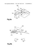 DEVICE, SYSTEM AND METHOD FOR COMPRESSION TREATMENT OF A BODY PART diagram and image