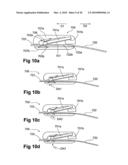 DEVICE, SYSTEM AND METHOD FOR COMPRESSION TREATMENT OF A BODY PART diagram and image