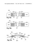 DEVICE, SYSTEM AND METHOD FOR COMPRESSION TREATMENT OF A BODY PART diagram and image