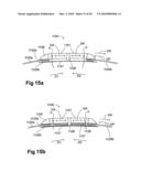 DEVICE, SYSTEM AND METHOD FOR COMPRESSION TREATMENT OF A BODY PART diagram and image