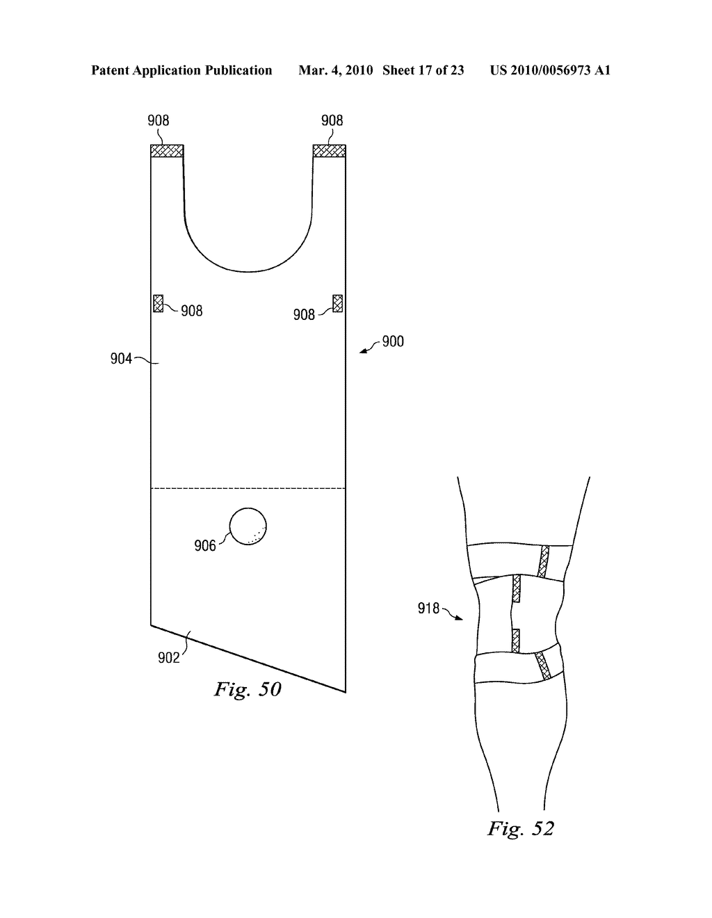 Therapeutic Compression Garments - diagram, schematic, and image 18