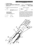 Externally adjustable blood flow valve diagram and image