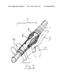 Externally adjustable blood flow valve diagram and image