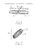 Externally adjustable blood flow valve diagram and image