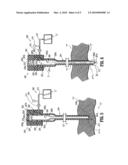 PNEUMOPERITONEUM NEEDLE diagram and image