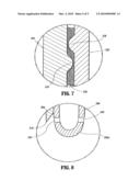 PNEUMOPERITONEUM NEEDLE diagram and image