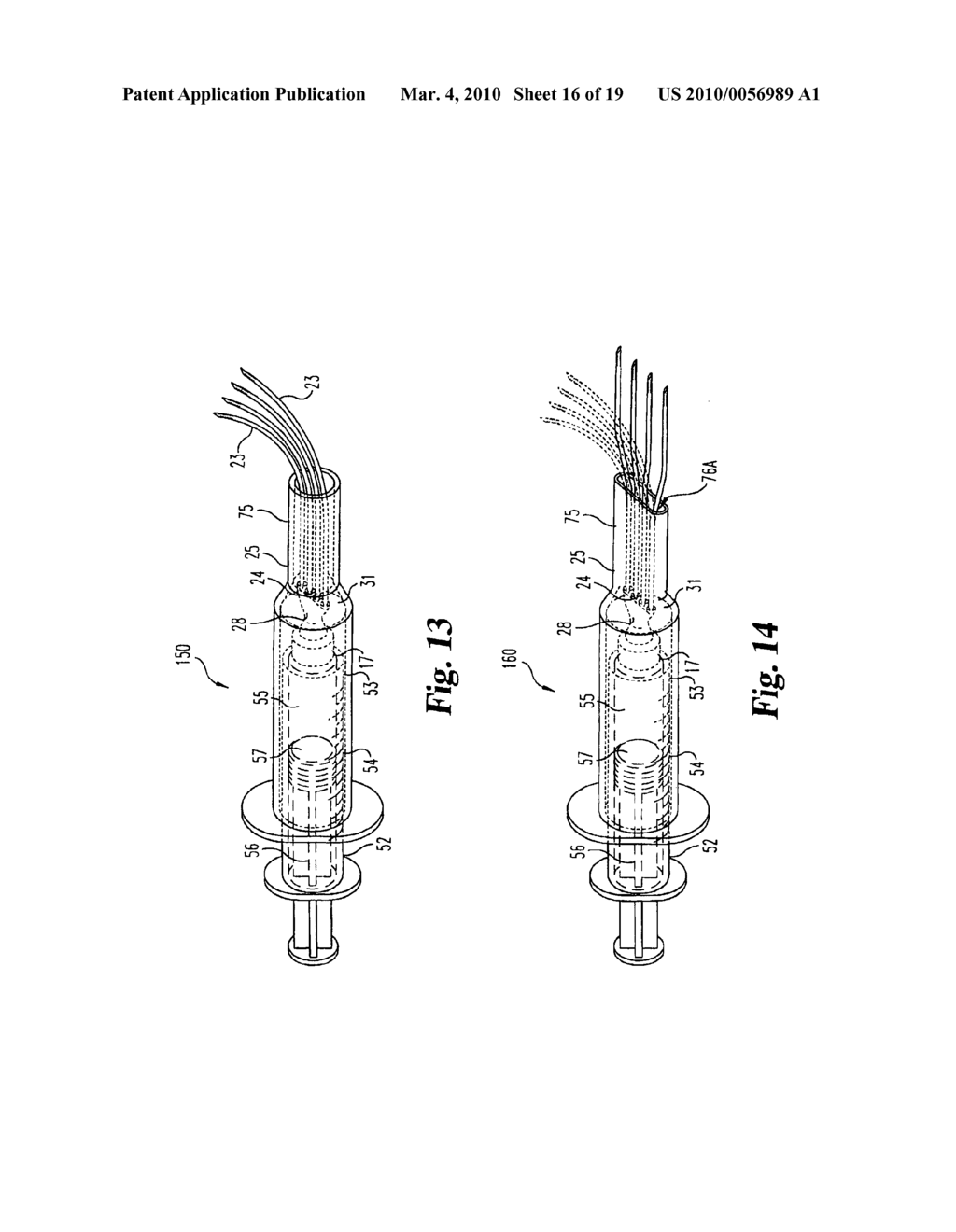 INSTRUMENTATION FOR INJECTION OF THERAPEUTIC FLUID INTO JOINTS - diagram, schematic, and image 17