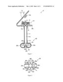 INTRACORPOREAL INDWELLING EQUIPMENT diagram and image