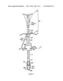 INTRACORPOREAL INDWELLING EQUIPMENT diagram and image