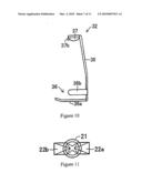 INTRACORPOREAL INDWELLING EQUIPMENT diagram and image