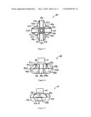 INTRACORPOREAL INDWELLING EQUIPMENT diagram and image