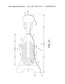 DYNAMIC FITTING BODY ADHERING ABSORBENT ARTICLE diagram and image