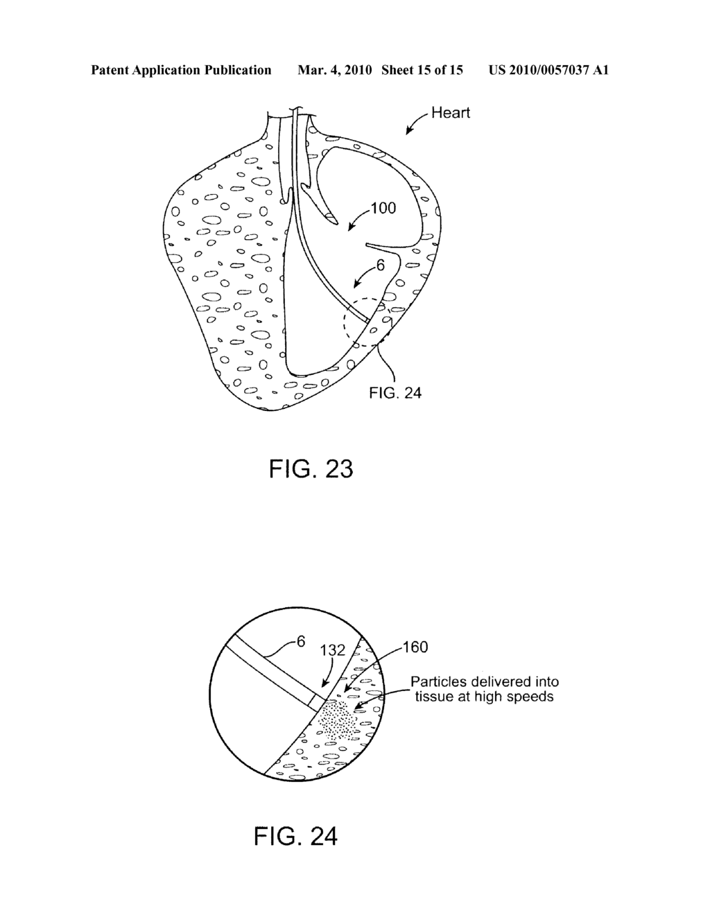 Agent Delivery Catheters - diagram, schematic, and image 16
