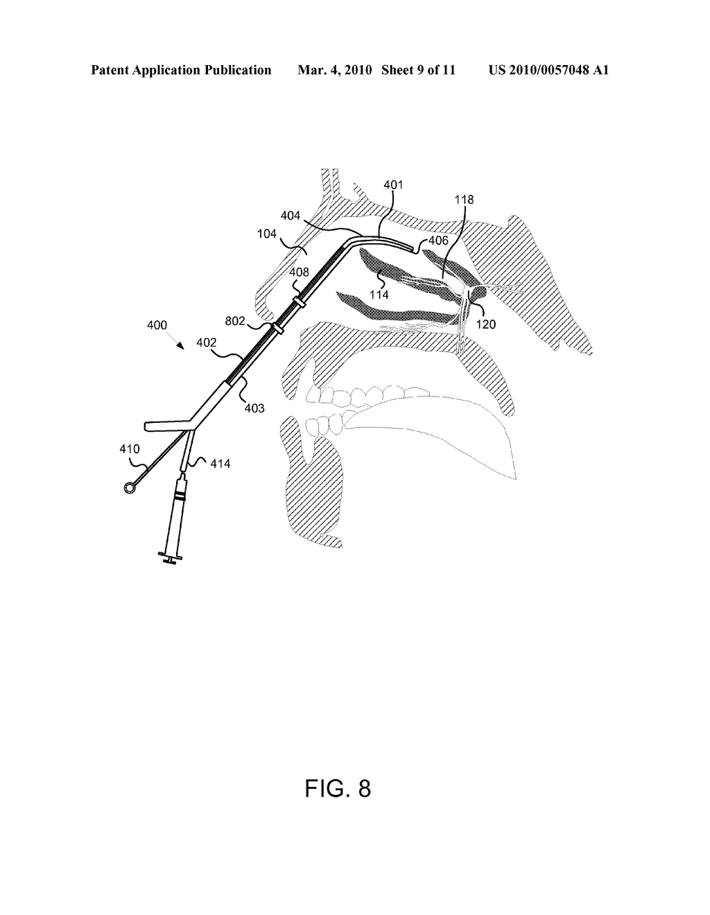 Apparatus, System, and Method for Treating Atypical Headaches - diagram, schematic, and image 10