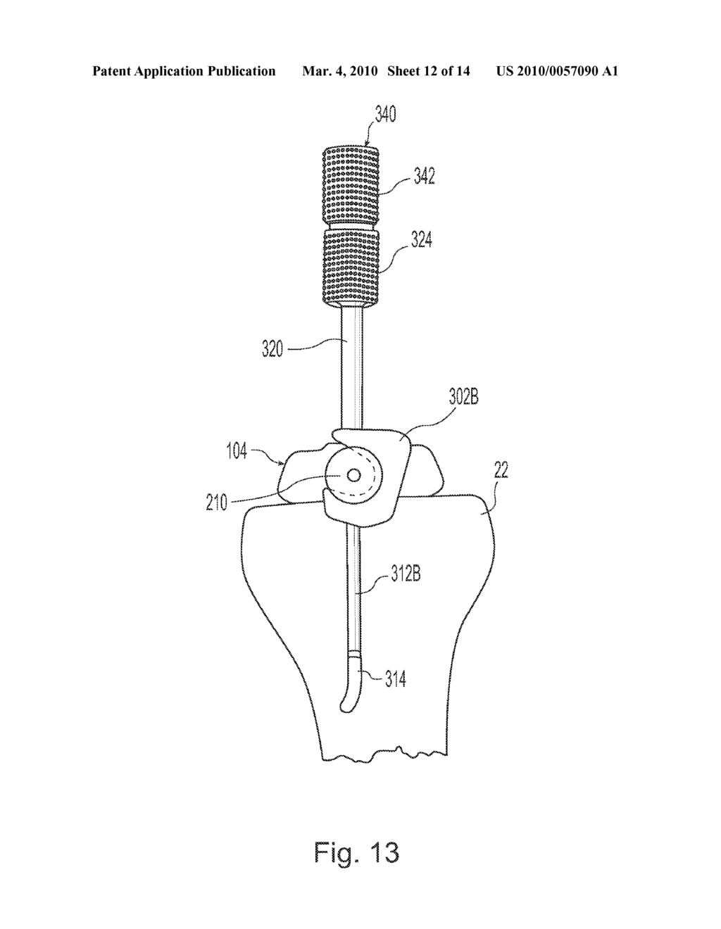 TRANS-CUT SLOT ADJUSTMENT MECHANISM - diagram, schematic, and image 13