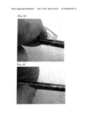 INJECTOR FOR EYE diagram and image